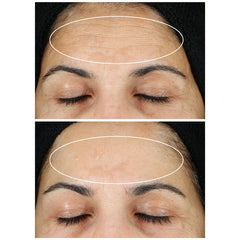 StriVectin Super-C Retinol Brighten And Correct Vitamin C Serum