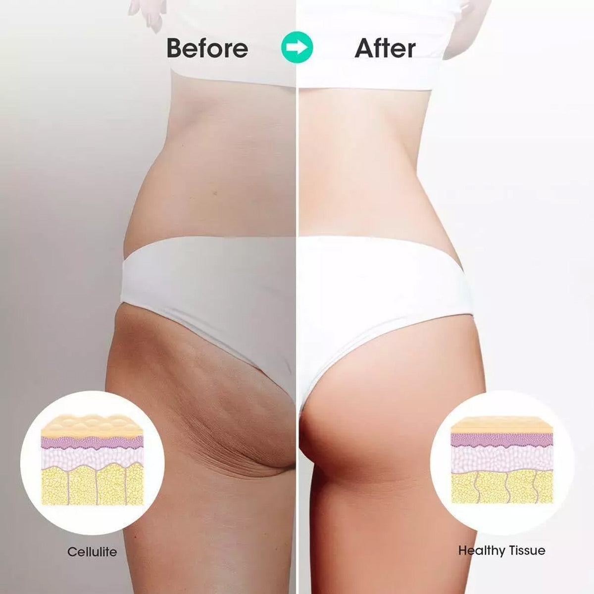 Muscle Roller Stick Full Body Fitness Massage Tool for Home and Gym Use - Black