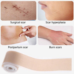 Silicone Gel Tape Scar Removal Self-Adhesive Efficient Scar Removal Patch Tapes - 4*150CM